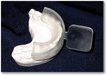teeth bleaching tray teeth bleaching tray