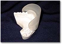 teeth bleaching tray teeth bleaching tray